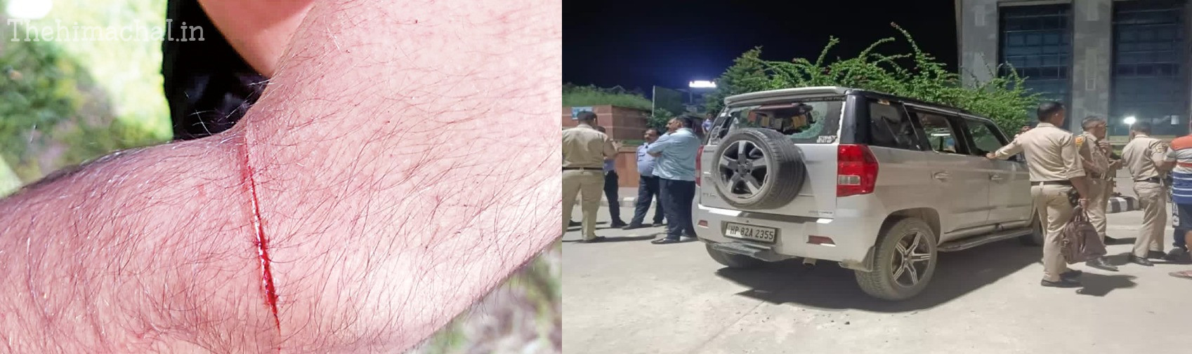 attack-on-trainee-doctor-in-tmc-hospital