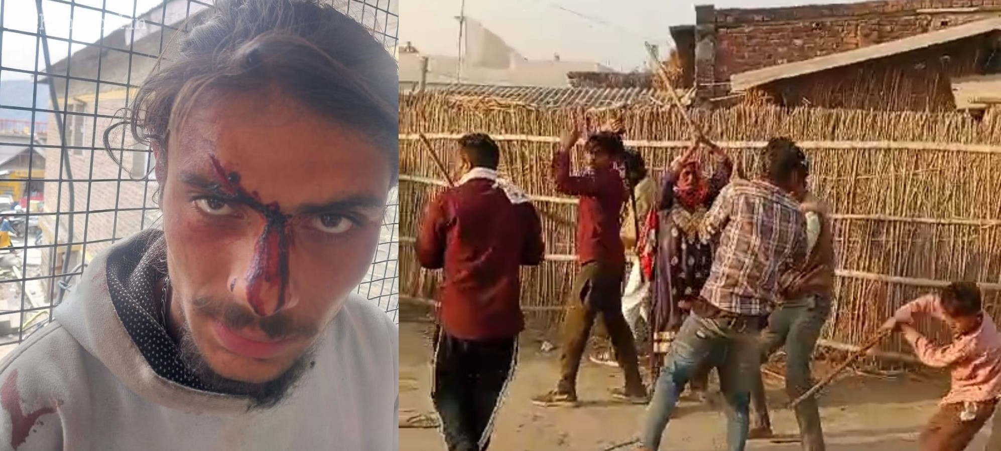 Chamba News: रास्ते के विवाद में भाई-बहन पर बेलचे से हमला, दोनों गंभीर घायल