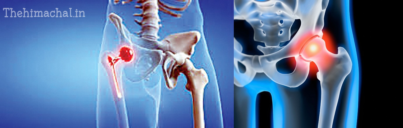 dharamshala-first-hip-replacement-surgery-success