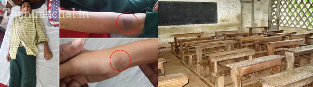 teacher-beats-class-9-student-for-making-noise