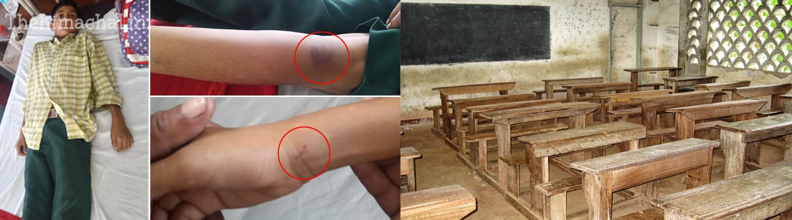 teacher-beats-class-9-student-for-making-noise